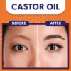 castor-oil-b+5