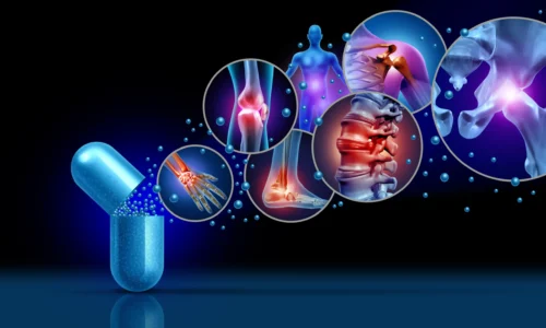 Supplements for Joint Health Image