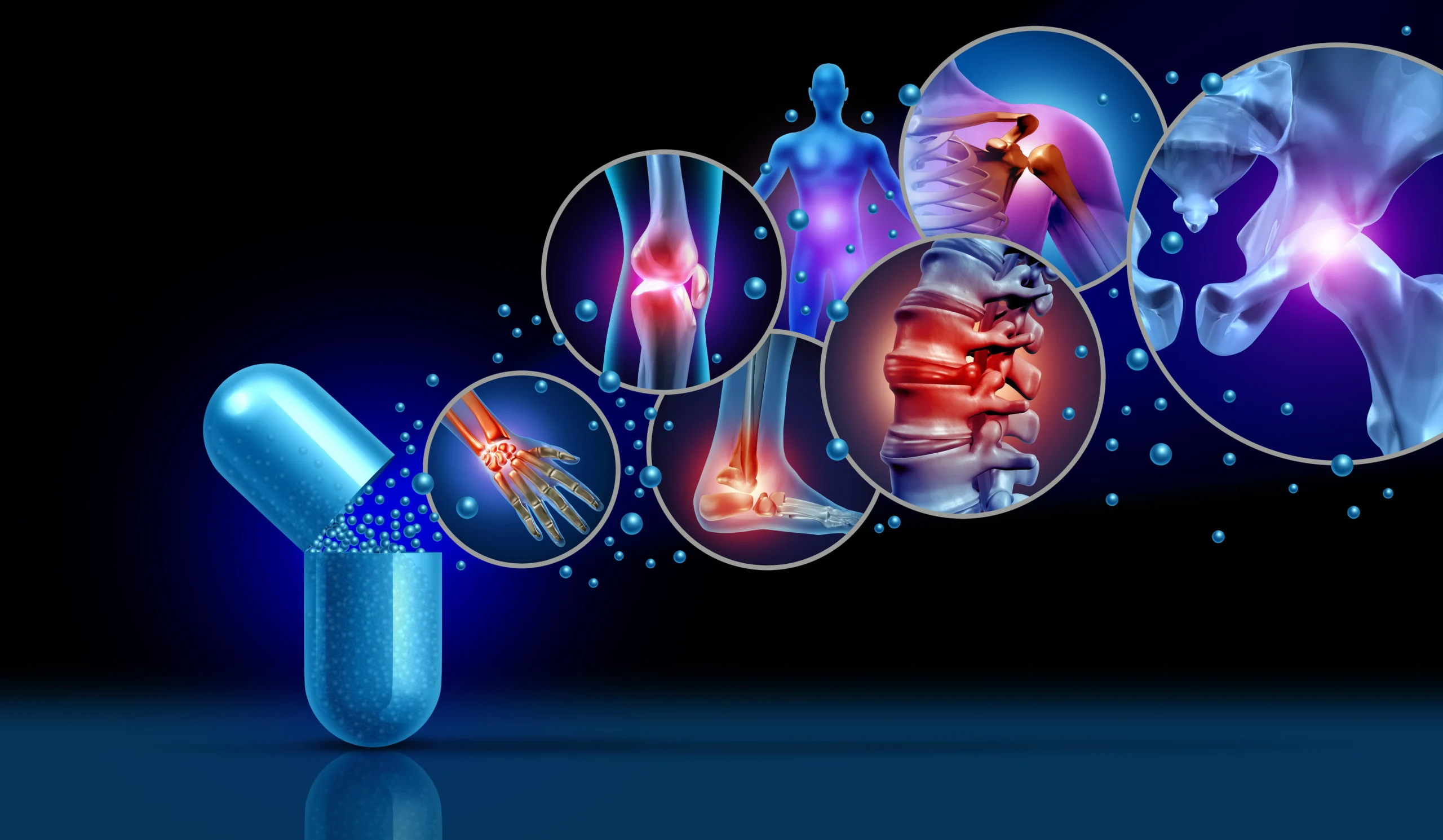 Supplements for Joint Health Image